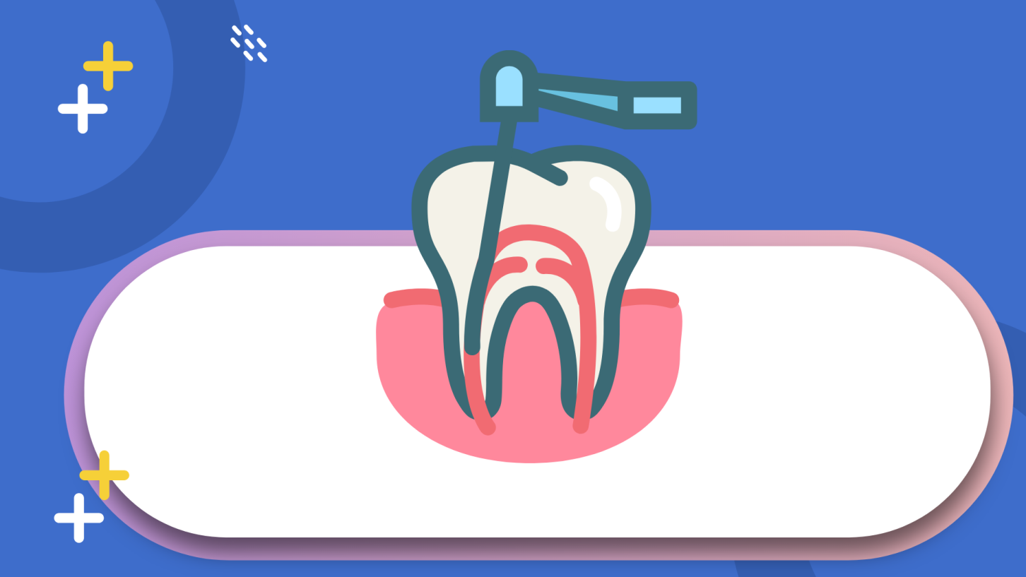 รักษาคลองรากฟัน