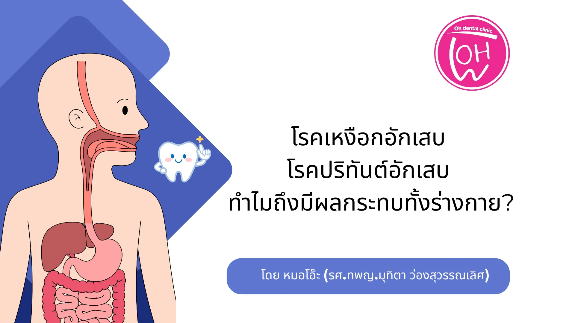 โรคเหงือกอักเสบ/โรคปริทันต์อักเสบ ทำไมถึงมีผลกระทบทั้งร่างกาย?