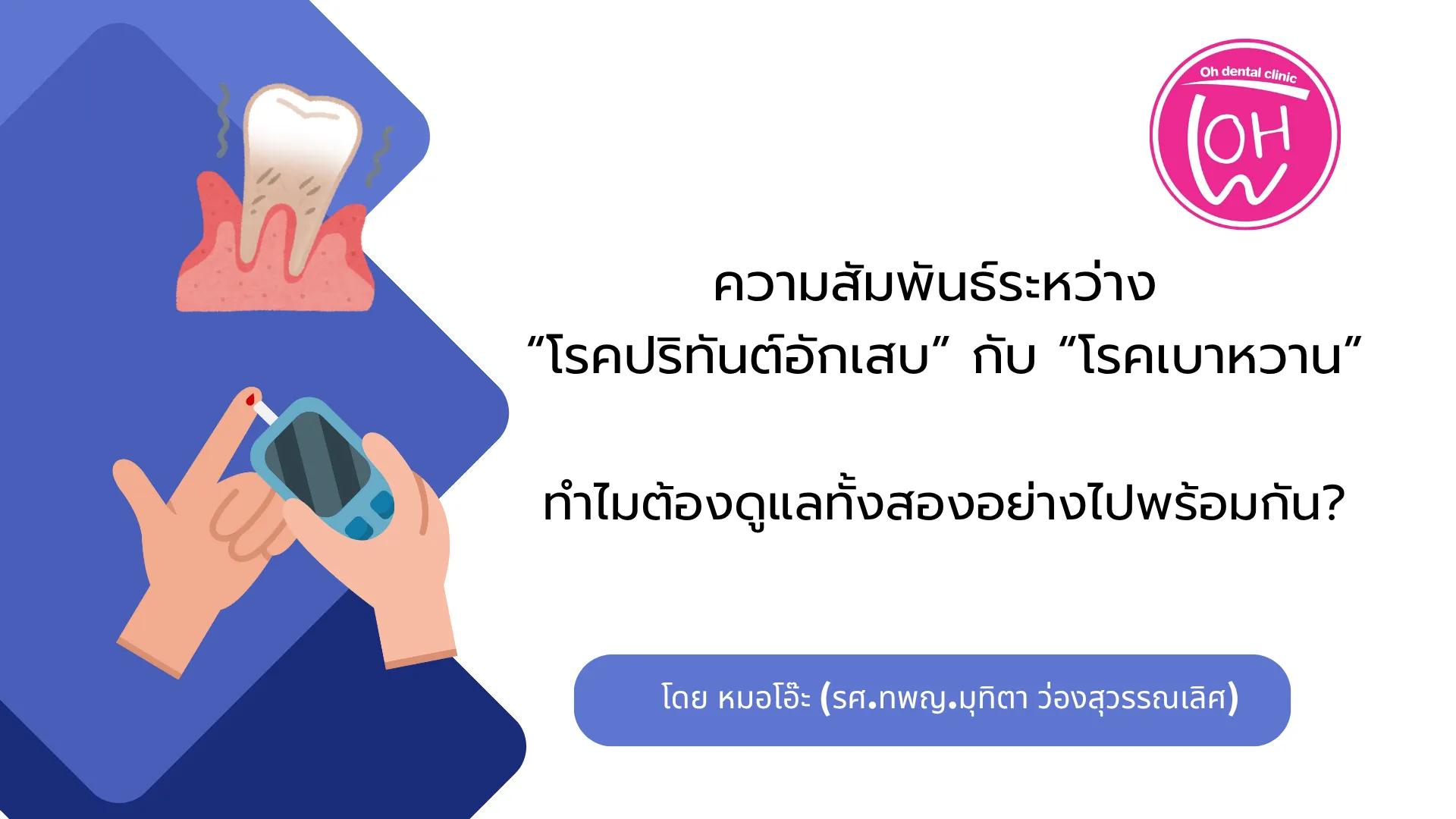 ความสัมพันธ์ระหว่าง “โรคปริทันต์อักเสบ” กับ “โรคเบาหวาน”