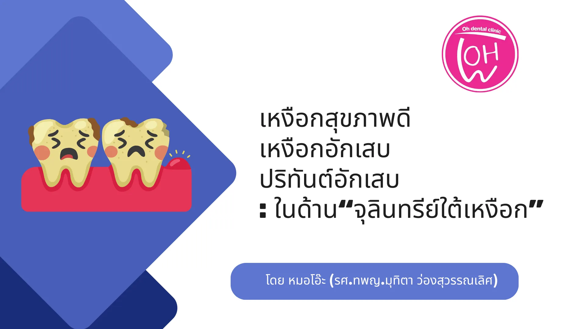 ความแตกต่างของ เหงือกสุขภาพดี เหงือกอักเสบ และปริทันต์อักเสบ : ในด้าน “จุลินทรีย์ใต้เหงือก”