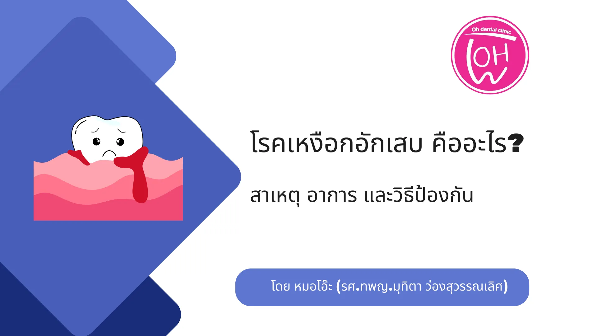 โรคเหงือกอักเสบคืออะไร?