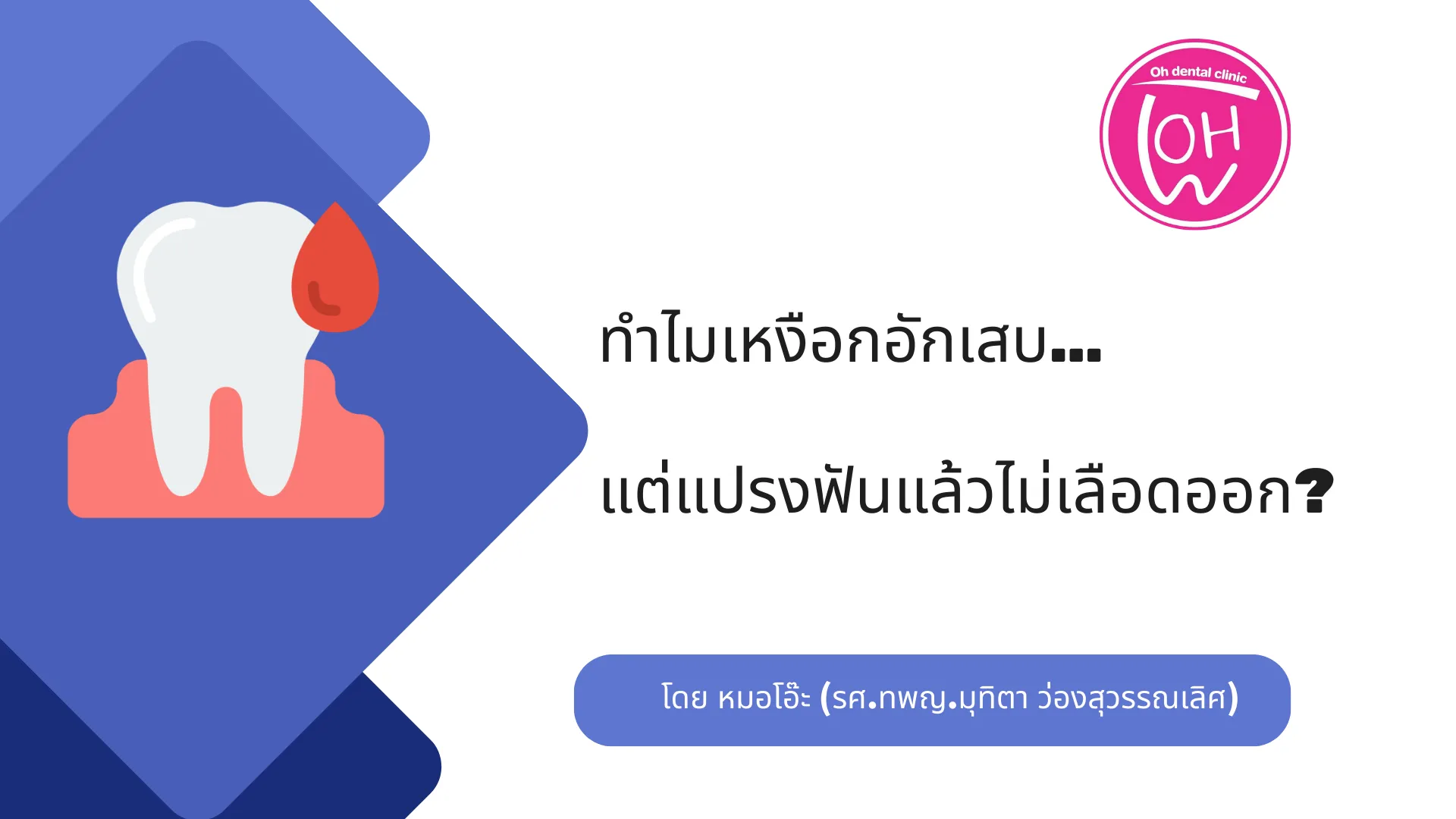 ทำไมเหงือกอักเสบ…แต่แปรงฟันแล้วไม่เลือดออก?