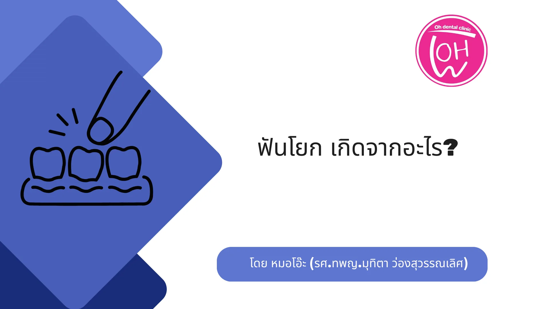 ฟันโยกเกิดจากอะไร? 