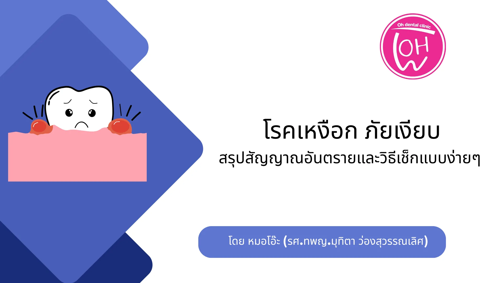 เหงือกของคุณยังแข็งแรงดีอยู่ไหม? เช็ก 5 สัญญาณอันตรายของโรคเหงือกที่ห้ามมองข้าม