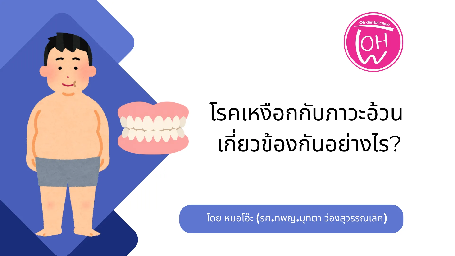 โรคเหงือกกับภาวะอ้วน เกี่ยวข้องกันอย่างไร?