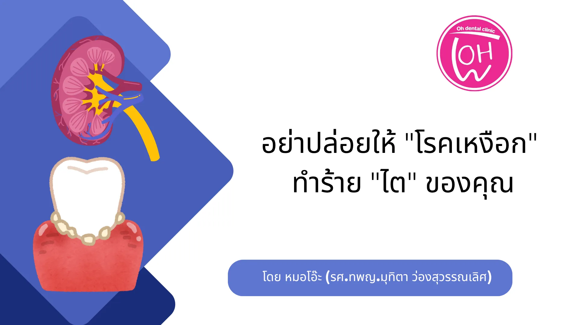 อย่าปล่อยให้ "โรคเหงือก" ทำร้าย "ไต" ของคุณ