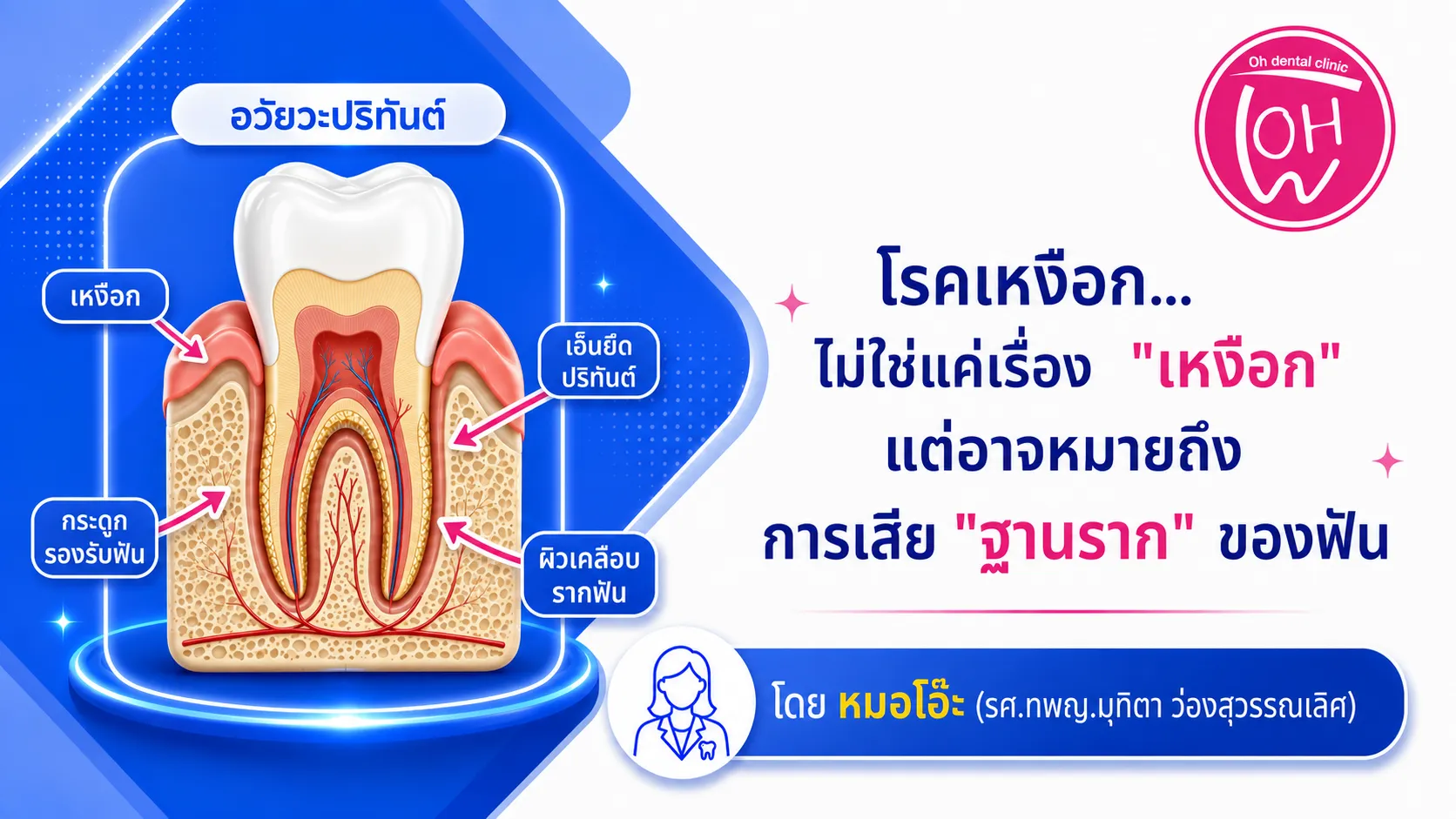 🦷 โรคเหงือก... ไม่ใช่แค่เรื่อง "เหงือก" แต่อาจหมายถึงการเสีย "ฐานราก" ของฟัน